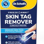 Best Skin Tag Remover – Dr. Scholl’s Freeze Away Kit Review