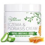Best Moisturizer – Wild Naturals Eczema & Psoriasis Cream Review