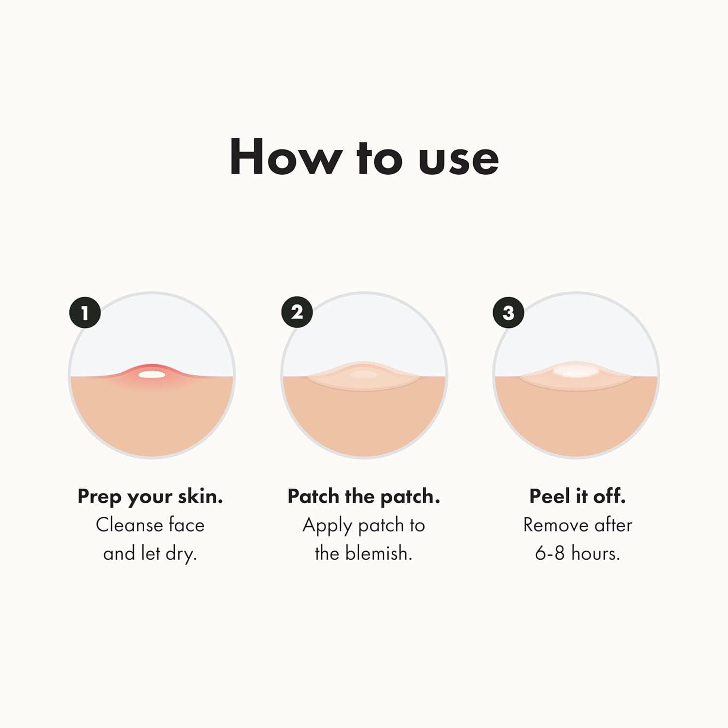 Best Acne Spot Treatments – Mighty Patch Hero Cosmetics Pimple Patches, 36 Ct | #1 Hydrocolloid Zit & Whitehead Shrinker Review